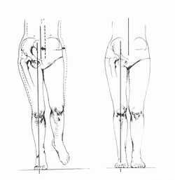 歩行の立脚中期における骨盤の側方移動